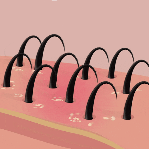 Calm itchy scalp