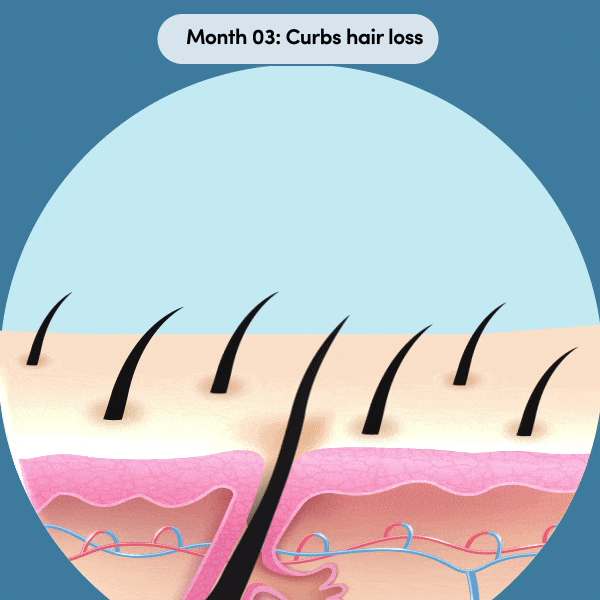 Curbs hair loss