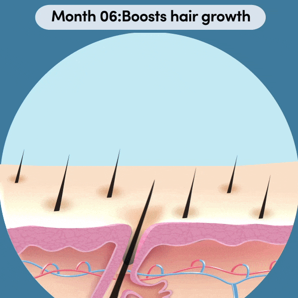 Boosts hair growth