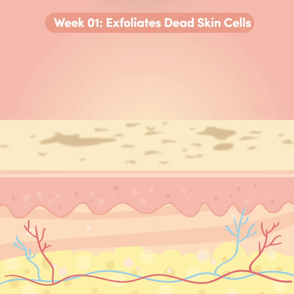 Exfoliates dead skin cells