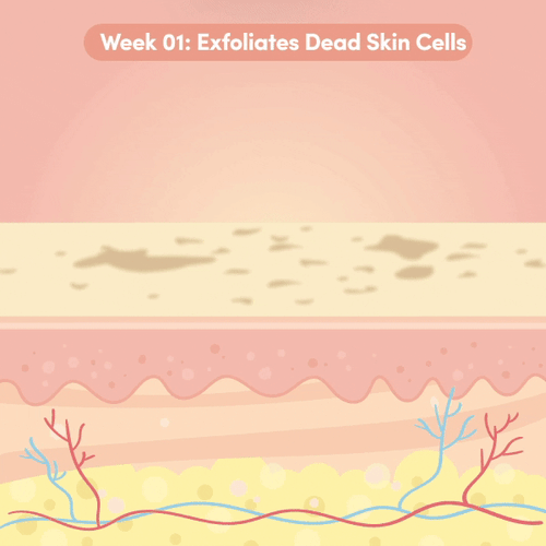 Exfoliates dead skin cells