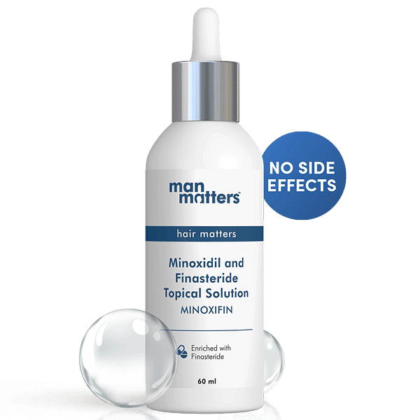 Minoxidil and Finasteride solution to prevent hair loss 