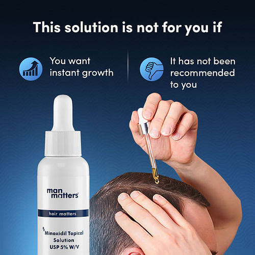 https://ik.manmatters.com/mosaic-wellness/image/upload/f_auto,w_800,c_limit/v1653487281/Man%20Matters/Minoxidil%20Plain/VIEW%20ALL%20IMAGES/This_Solution_is_not_for_You_If.jpg